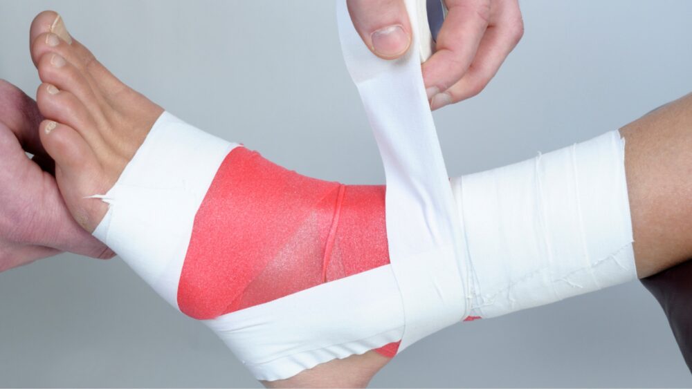 Patient, der sich am Sprunggelenk durch Sport verletzt hat